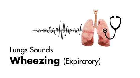 喘鳴とヒュー音の違い：音の世界の微妙な境界線